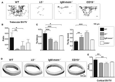 Disruption of the preB Cell Receptor Complex Leads to Decreased Bone Mass